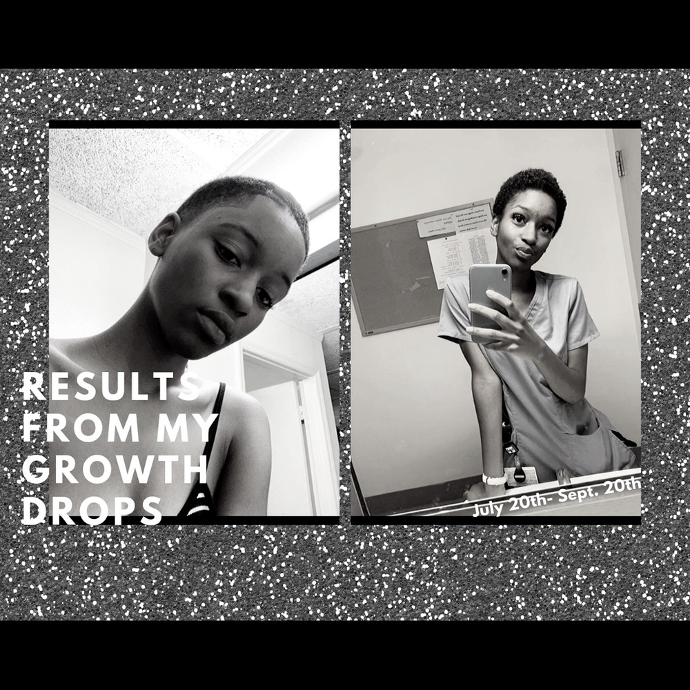 Growth Drops - Picture 5 of 5